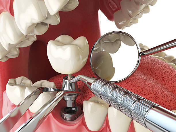 Best Walk-In Emergency Dental Services in Bernardsville, NJ